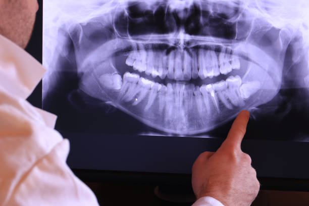 Best Emergency Wisdom Teeth Removal in Henagar, AL
